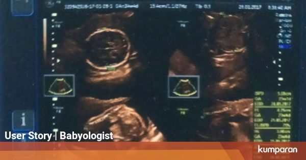 Keputihan 38 Minggu Saat Keluar Hamil